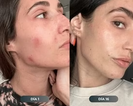 Foto de reseña de María - 37 años